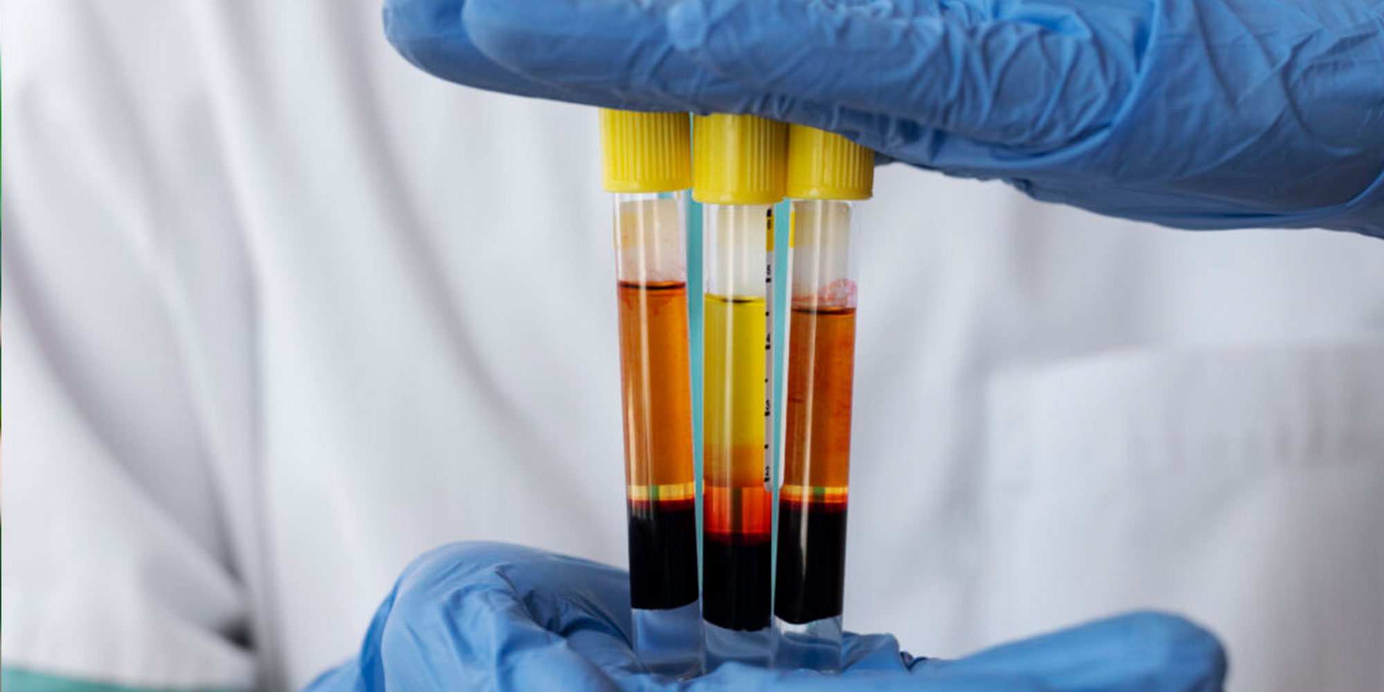 close up of Platelet tubes