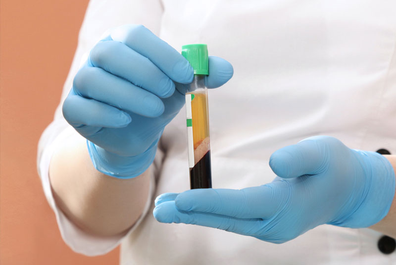 close up of Platelet tubes