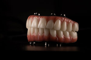 Full Mouth Reconstruction: Rebuilding Function, Comfort, and Confidence from the Ground Up